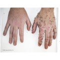 repelent-spray-mugga-9-5-deet-75-ml-6a5092282f1d493e8fb7e34fc2a5029d-1ab0fad0.jpg