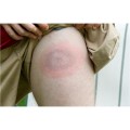 Balsam_kojacy_Mugga_na_ukaszenia_i_poparzenia_50ml_lentus_militaria_15.jpg